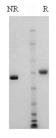 Sample gel image